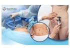Affordable Liposuction Cost in Hyderabad for a Flawless Look
