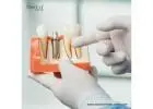Dental Implants Brands in Honduras for Reliable Restorations