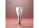 Experienced Dental Implant Manufacturers in Honduras