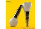 Dental Implant Products Wholesale In Paraguay For Best Deals