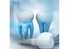 Next-Gen Dental Implant Manufacturers in Honduras 2025