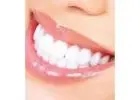 Affordable dental braces in Dubai