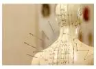 Acupuncture Toronto: Safe & Natural Way for Pain Relief