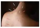 Acupuncture Treatment Toronto: Natural Relief for Pain and Stress