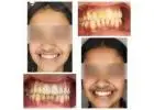Best Dentist in Delhi NCR | Dr. Bhutani Dental Clinic | Advanced Dental Care