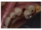 Holistic Dentist in Mexico – Natural, Biocompatible Care for Your Health and Smile