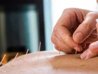 Acupuncture Toronto: Personalized Sessions with Well-Trained Professionals