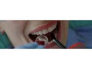 Find top-notch surgeons and dental equipment for Wisdom teeth removal Tijuana Find top-notch surgeons and dental equipment for Wisdom teeth removal Tijuana