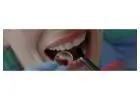Find top-notch surgeons and dental equipment for Wisdom teeth removal Tijuana