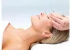 Acupuncture Treatment in Steeles: Rediscover Balance through Traditional Therapy