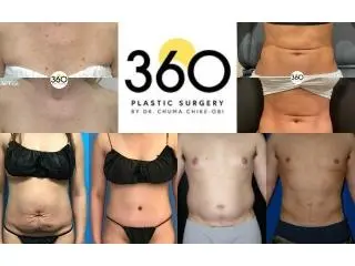 360 Plastic Surgery 360 Plastic Surgery