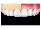 Trusted Dental Clinic in Tijuana – Comprehensive Care for a Brighter, Healthier Smile