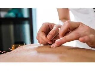 Acupuncture Toronto: Traditional Therapy for Pain Relief and Wellness Acupuncture Toronto: Traditional Therapy for Pain Relief and Wellness