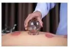 Cupping Therapy Toronto: Authentic Fire Cupping for Deep Pain Relief and Detoxification