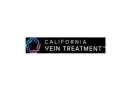 Vein Treatment California
