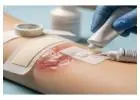 Chronic Wound Care Philadelphia for Non-Healing Wounds