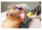 IPL (Intense Pulsed Light) - Mid Florida Dermatology & Plastic Surgery