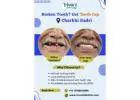 Teeth Cap Treatment in Charkhi Dadri | Triveni Dental