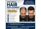 Non Surgical Hair Replacement For Men in Fresno, CA.