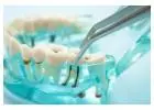 Professional Dental Cleaning Services in Rosedale, MD | Rosedale Smiles