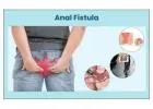 Permanent Relief with Expert Ayurvedic Piles & Fissure Care in Delhi