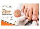 Best Nail Fungus Treatment