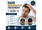 Hair Regeneration Treatment in Fresno CA
