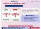 Expert Ovarian TB Care by the Best Gynecologist in Gaur City