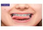The True Value of Dental Implants: A Comprehensive Cost and Care Guide