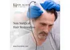 Non surgical hair restoration