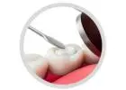 Dental Fillings Sydney | TLC Dentist