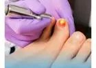 Podiatrist Miranda | Podiatry First