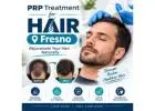 prp treatment for hair Fresno