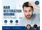 Hair Regeneration Treatment in Fresno