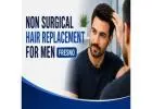 Non Surgical Hair Replacement For Men fresno