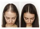Hair Loss Solutions Dallas | Women’s Thinning Hair Specialist