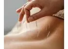 Pain Management Acupuncture in NYC | Back, Neck & Sciatica Relief