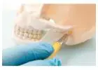 Mitcham Dentist for Reliable and Professional Dental Services