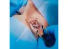 Discover Advanced Lasik Eye Surgery Treatment in Rajkot