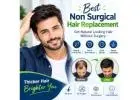 best non surgical hair replacement